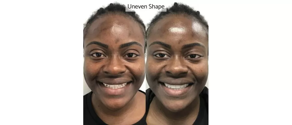 Whites Dental Marble Arch (W2)