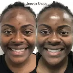 Whites Dental Marble Arch (W2)